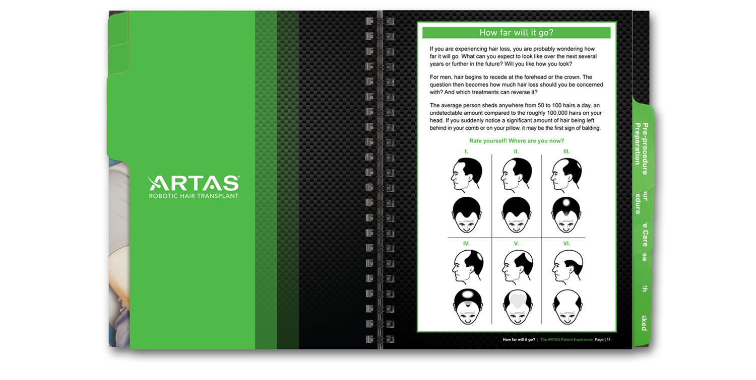 artas-patient-guide-spread